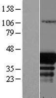 EAF1 Human Over-expression Lysates NM_033083