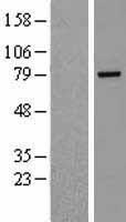 Rhophilin 2 (RHPN2) Human Over-expression Lysates NM_033103