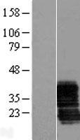 ZCRB1 Human Over-expression Lysates NM_033114