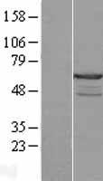 CABS1 Human Over-expression Lysates NM_033122