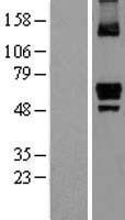 ITPRIP Human Over-expression Lysates NM_033397