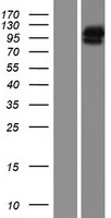 KIAA1751 (CFAP74) Human Over-expression Lysates NM_001080484