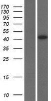 ls085453 tspyl5 human over expression lysates nm 033512 wb testing 1