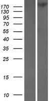 TNKS1BP1 Human Over-expression Lysates NM_033396