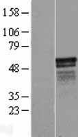 ls085457 cipc human over expression lysates nm 033426 wb testing 1