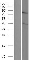 DIXDC1 Human Over-expression Lysates NM_001037954