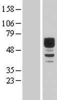 DIXDC1 Human Over-expression Lysates NM_033425