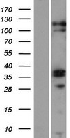ZC3H12C Human Over-expression Lysates NM_033390