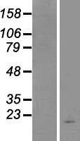 TSLP Human Over-expression Lysates NM_033035