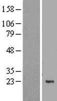ls085509 mbd3l1 human over expression lysates nm 145208 wb testing 1