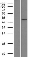HSFY1 Human Over-expression Lysates NM_033108