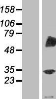 RNF87 (TRIM4) Human Over-expression Lysates NM_033091
