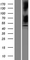 SERPINB12 Human Over-expression Lysates NM_080474