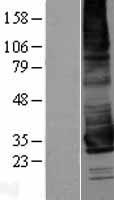 KCNK17 Human Over-expression Lysates NM_031460