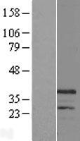 CHRFAM7A Human Over-expression Lysates NM_148911