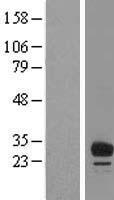 ls089853 mvb12b human over expression lysates nm 001011703 wb testing 2