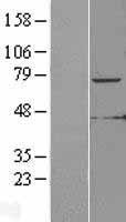 KLHL6 Human Over-expression Lysates NM_130446