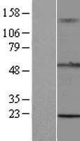 ls089870 rnf93 trim15 human over expression lysates nm 033229 wb testing 1