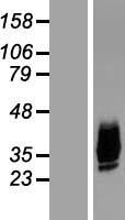 Aquaporin 10 (AQP10) Human Over-expression Lysates NM_080429
