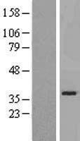 SLC25A21 Human Over-expression Lysates NM_030631