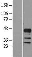 LHX4 Human Over-expression Lysates NM_033343
