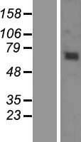 KBTBD6 Human Over-expression Lysates NM_152903