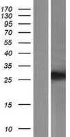 ls089894 tmem116 human over expression lysates nm 138341 wb testing 1