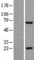 ls089944 glb1l2 human over expression lysates nm 138342 wb testing 1