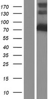 KLC4 Human Over-expression Lysates NM_201521