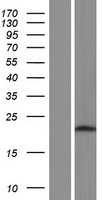 ls089978 atpbd4 dph6 human over expression lysates nm 001141972 wb testing 2