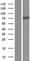 CCDC120 Human Over-expression Lysates NM_001163322