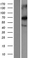 CCDC120 Human Over-expression Lysates NM_033626