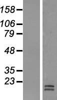 LACRT Human Over-expression Lysates NM_033277