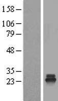 TSR2 Human Over-expression Lysates NM_058163