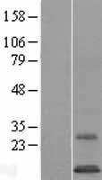SYS1 Human Over-expression Lysates NM_033542