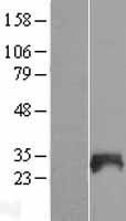 SNX21 Human Over-expression Lysates NM_152897