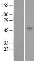 ls090204 zswim1 human over expression lysates nm 080603 wb testing 1