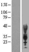 CEACAM21 Human Over-expression Lysates NM_033543