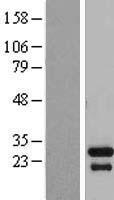 TGIF2LX Human Over-expression Lysates NM_138960