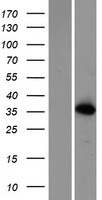 ATPBD3 (CTU1) Human Over-expression Lysates NM_145232