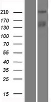 C15orf42 (TICRR) Human Over-expression Lysates NM_152259