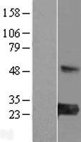 MED30 Human Over-expression Lysates NM_080651