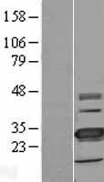 ls090407 tmem41a human over expression lysates nm 080652 wb testing 1