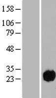 ls090416 ccdc32 human over expression lysates nm 052849 wb testing 2
