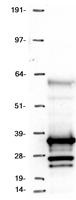 ls090417 traf4af1 knstrn human over expression lysates nm 001142762 wb testing 3