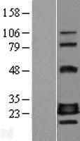 GADD45GIP1 Human Over-expression Lysates NM_052850