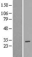 YIF1B Human Over-expression Lysates NM_001145462