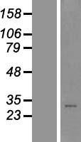 C1orf201 (STPG1) Human Over-expression Lysates NM_178122