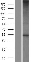 C19orf52 (TIMM29) Human Over-expression Lysates NM_138358