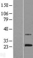 ls090589 znf625 human over expression lysates nm 145233 wb testing 1